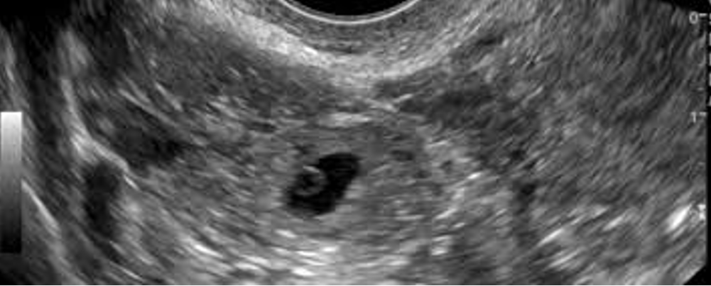 Screenshot 2026-02-19 045940.png