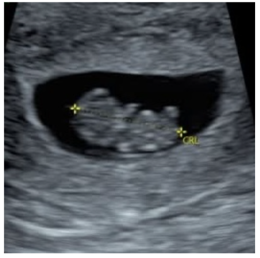 Screenshot 2026 04 15 at 4.27.32 PM