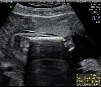 US2026Picture3