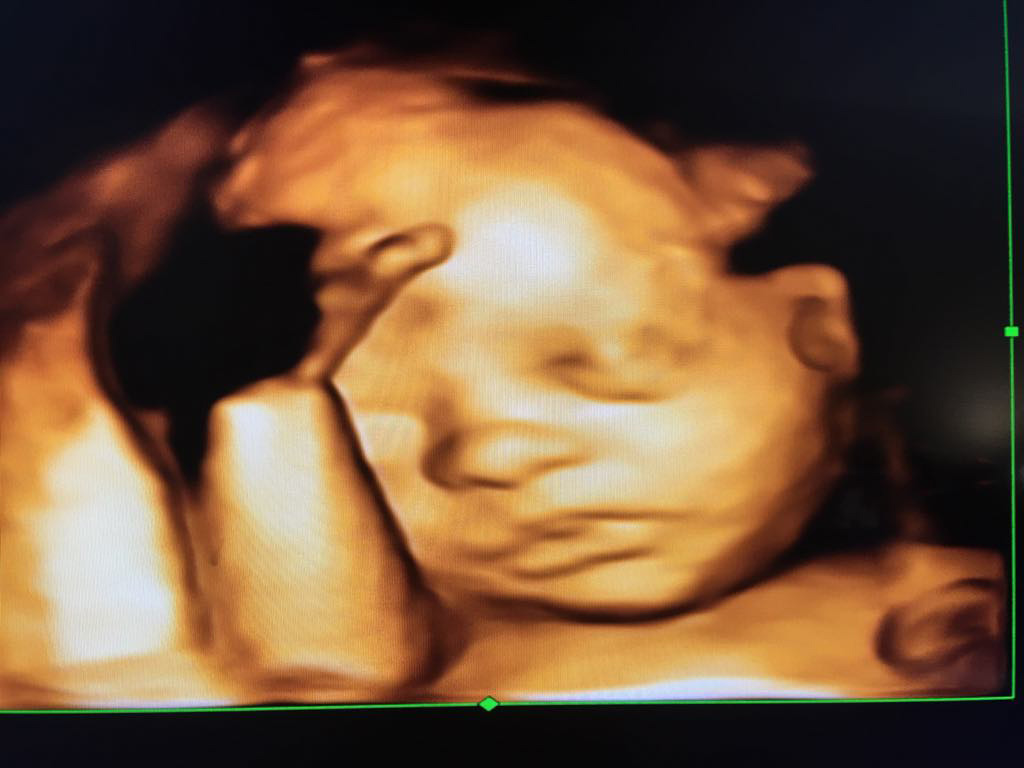 tig ultrasound